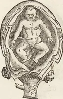 Picture 33 of 273 from Vlyssis Aldrovandi Patricii Bononiensis Monstrorvm Historia: cum Indice copiosissimo (1642), leaf 75
