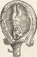 Picture 35 of 273 from Vlyssis Aldrovandi Patricii Bononiensis Monstrorvm Historia: cum Indice copiosissimo (1642), leaf 76