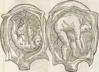 Picture 37 of 273 from Vlyssis Aldrovandi Patricii Bononiensis Monstrorvm Historia: cum Indice copiosissimo (1642), leaf 77