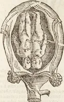 Picture 40 of 273 from Vlyssis Aldrovandi Patricii Bononiensis Monstrorvm Historia: cum Indice copiosissimo (1642), leaf 79
