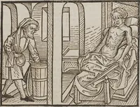 Picture 40 of 168 from Johann Lange ; Giovanni Boccaccio (Druck) ; Johannes Adelphus (Druck) ; Thomas Lirer (Druck) ; Johannes de Capua (Druck) ; Jacobus de Cessolis (Druck), leaf 411