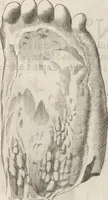 An illustration from Michaelis Mercati Samminiatensis Metallotheca: Opus Posthumum, Auctoritate, & Munificentiâ Clementis Undecimi Pontificis Maximi E' tenebris in lucem eductum; Opera autem, & studio Joannis Mariae Lancisii Archiatri Pontificii Illustratum. Cui Accessit Appendix Cum XIX. Recens Inventis Iconibus (1719)
