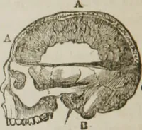 An illustration from Elements of phrenology (1845)