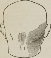 An illustration from Elements of phrenology (1845)