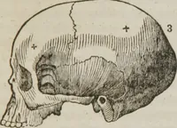 An illustration from Elements of phrenology (1845)