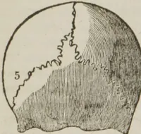 An illustration from Elements of phrenology (1845)