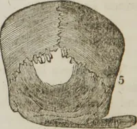 An illustration from Elements of phrenology (1845)