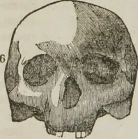 An illustration from Elements of phrenology (1845)