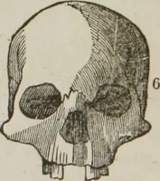 An illustration from Elements of phrenology (1845)
