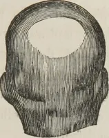 An illustration from A system of phrenology (1834)