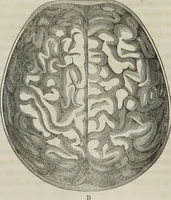 An illustration from A system of phrenology (1834)