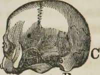 An illustration from A system of phrenology (1834)
