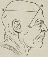 An illustration from A system of phrenology (1834)