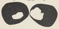 An illustration from Diseases of the eye (1900)
