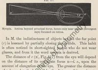 Picture 8 of 13 from Diseases of the eye (1900), leaf 342