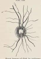 An illustration from Diseases of the eye (1900)