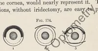 Picture 11 of 13 from Diseases of the eye (1900), leaf 447