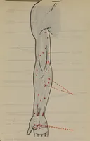 An illustration from Nursing and care of the nervous and the insane (1915)