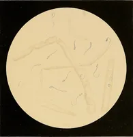 Picture 63 of 89 from An atlas of clinical microscopy (1885), leaf 264