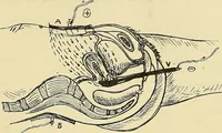 An illustration from The electro-therapeutic guide, or, A thousand questions asked and answered (1907)