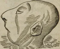 An illustration from Manual of phrenology, or The physiology of the human brain : embracing a full description of the phrenological organs, their exact location, and the peculiarities of character produced by their various degrees of development and combination (1839)