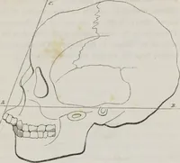An illustration from History and progress of phrenology : (read before the Western Phrenological Society, at Buffalo) (1839)
