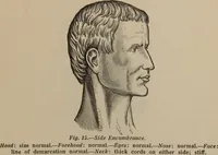 Picture 15 of 45 from The science of facial expression : the new system of diagnosis, based on original researches and discoveries (1917), leaf 40
