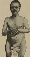 Picture 17 of 45 from The science of facial expression : the new system of diagnosis, based on original researches and discoveries (1917), leaf 41