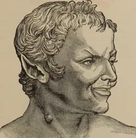 An illustration from The science of facial expression : the new system of diagnosis, based on original researches and discoveries (1917)