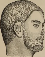 An illustration from The science of facial expression : the new system of diagnosis, based on original researches and discoveries (1917)