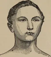 An illustration from The science of facial expression : the new system of diagnosis, based on original researches and discoveries (1917)