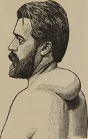 An illustration from The science of facial expression : the new system of diagnosis, based on original researches and discoveries (1917)