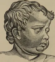 An illustration from The science of facial expression : the new system of diagnosis, based on original researches and discoveries (1917)