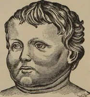 An illustration from The science of facial expression : the new system of diagnosis, based on original researches and discoveries (1917)