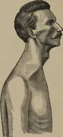 An illustration from The science of facial expression : the new system of diagnosis, based on original researches and discoveries (1917)
