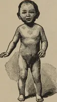 An illustration from The science of facial expression : the new system of diagnosis, based on original researches and discoveries (1917)