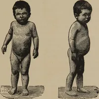 Picture 40 of 45 from The science of facial expression : the new system of diagnosis, based on original researches and discoveries (1917), leaf 84