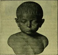 An illustration from La dégénérescence bachique et la névrose religieuse dans l'antiquité. Études medico-psychologiques, tirées des chefs-d'œuvre de la poésie, de l'histoire et de la philosophie, la Bible, Homère ... etc (1901)