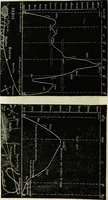 An illustration from Histoire de mes ascensions : récit de vingt-quatre voyages aériens [1868-1877] (1880)