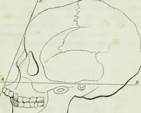 An illustration from History and progress of phrenology. (Read before the Western phrenological society, at Buffalo,) (1839)