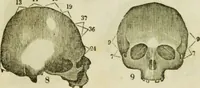 An illustration from Trials and triumphs of an orphan girl : or the biography of Mrs. Deiadamia Chase, physician and phrenologist (1859)
