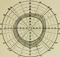 An illustration from Suggestive therapeutics : a treatise on the nature and uses of hypnotism (1889)