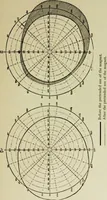An illustration from Suggestive therapeutics : a treatise on the nature and uses of hypnotism (1889)