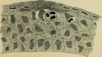 An illustration from Pestilentia in nummis. Geschichte der grossen Volkskrankheiten in numismatischen Documenten. Ein Beitrag zur Geschichte der Medicin und der Cultur (1882)