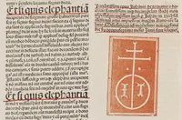 An illustration from Clarificatorium super nono Almansoris cum textu Rhasis