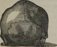 An illustration from A defence of phrenology (1847)