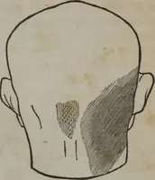 An illustration from A defence of phrenology (1847)