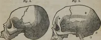 An illustration from A defence of phrenology (1847)