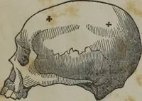 An illustration from A defence of phrenology (1847)