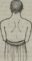 Picture 3 of 40 from Coombs's standard phrenology : exhibiting the exact phrenological admeasurements of above fifty distinguished and extraordinary personages, of both sexes : with skulls of the various nations of the world : embellished with above 50 engravings, and poetical descriptions of beauty, intellect, and physiognomy : with observations explanatory of the science, adapted to the character of [blank] (1841), leaf 9